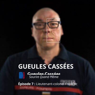 Lieutenant-colonel Frédéric : grand brûlé, se reconstruire et retourner au feu, podcast Gueules Cassées